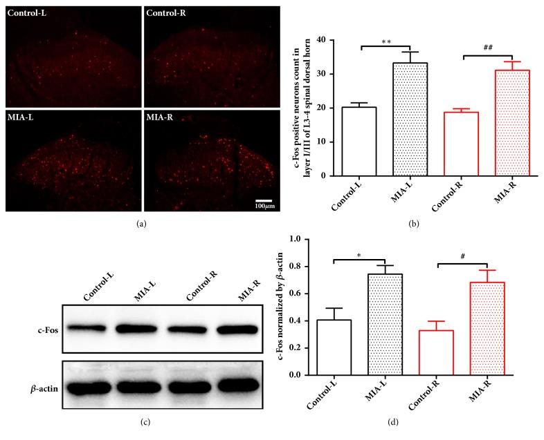 https://cdn.ncbi.nlm.nih.gov/pmc/blobs/2dfc/6383421/a9aa84cf9f13/ECAM2019-7493286.003.jpg