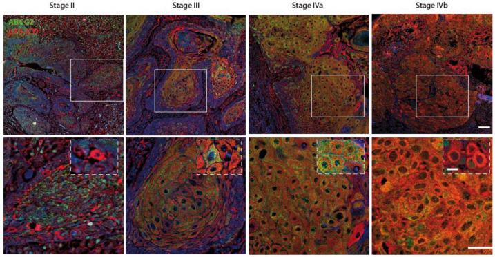 https://cdn.ncbi.nlm.nih.gov/pmc/blobs/2dfe/9179539/1b27232b33e1/cancers-14-02622-g003.jpg