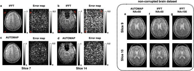 https://cdn.ncbi.nlm.nih.gov/pmc/blobs/2dff/11316714/3c4a65b570ad/10334_2024_1173_Fig2_HTML.jpg