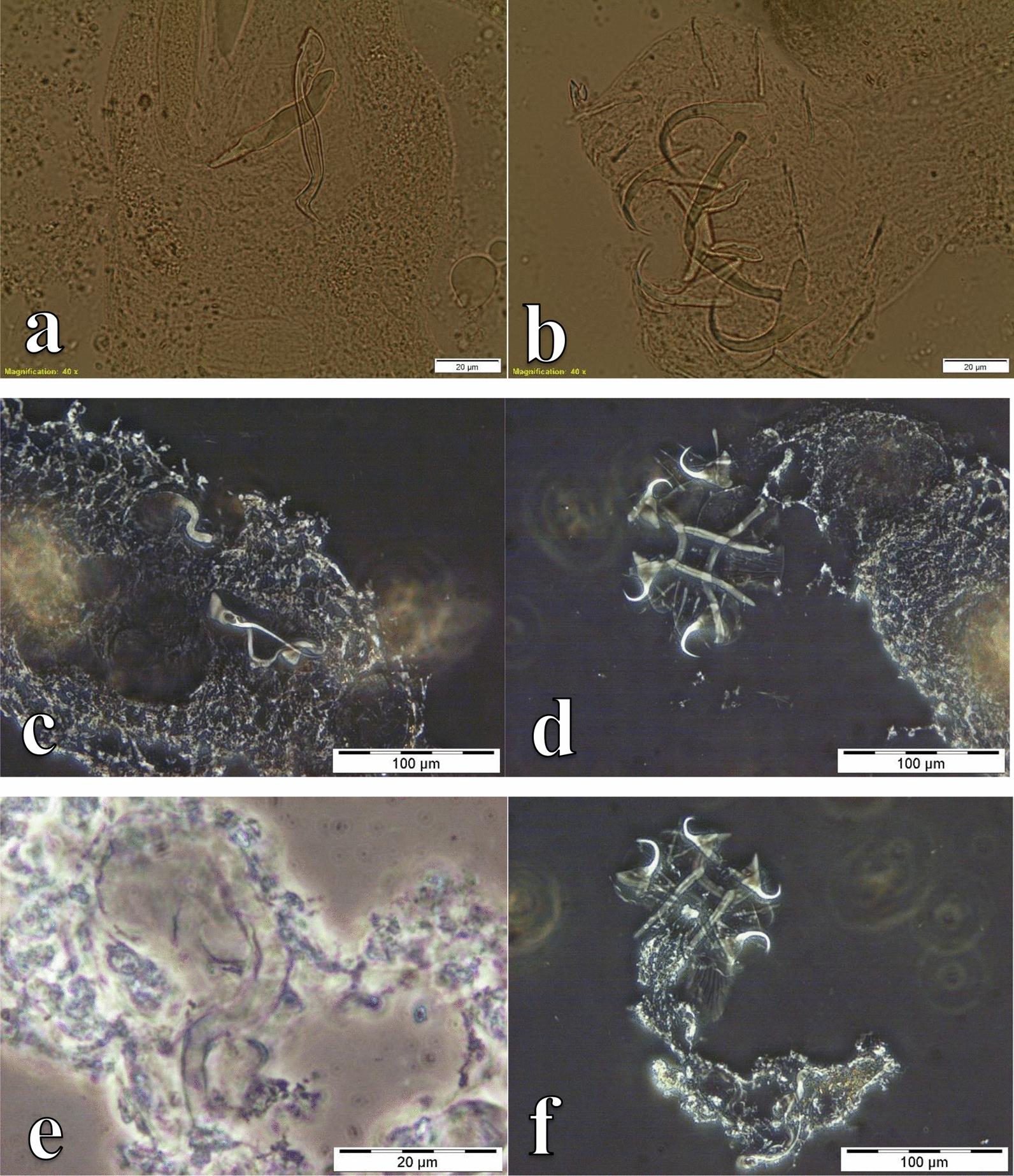 https://cdn.ncbi.nlm.nih.gov/pmc/blobs/2dff/9893698/65005a2f67d9/13071_2022_5637_Fig5_HTML.jpg