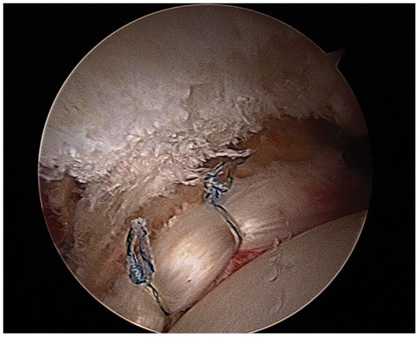 https://cdn.ncbi.nlm.nih.gov/pmc/blobs/2e03/3874222/36f009797429/10.1177_1941738113497678-fig5.jpg