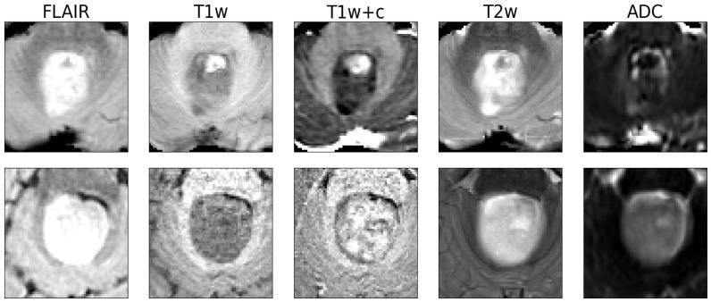 https://cdn.ncbi.nlm.nih.gov/pmc/blobs/2e07/11048511/2bc129dc2345/cancers-16-01474-g002.jpg