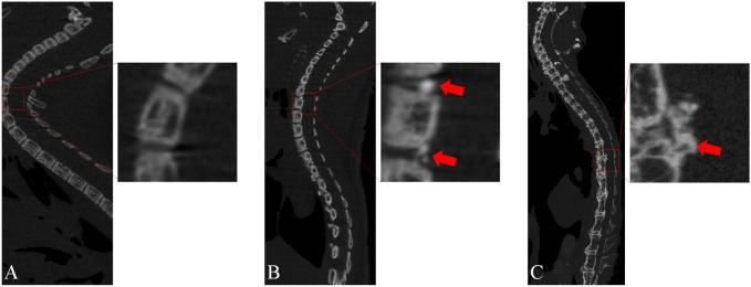https://cdn.ncbi.nlm.nih.gov/pmc/blobs/2e0a/10600381/b87e29dc57e8/fphys-14-1225898-g004.jpg