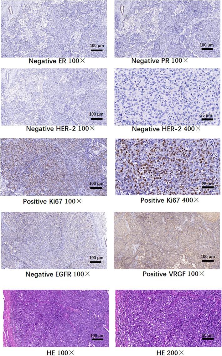 https://cdn.ncbi.nlm.nih.gov/pmc/blobs/2e14/12411264/42481a501c66/CCR3-13-e70850-g002.jpg