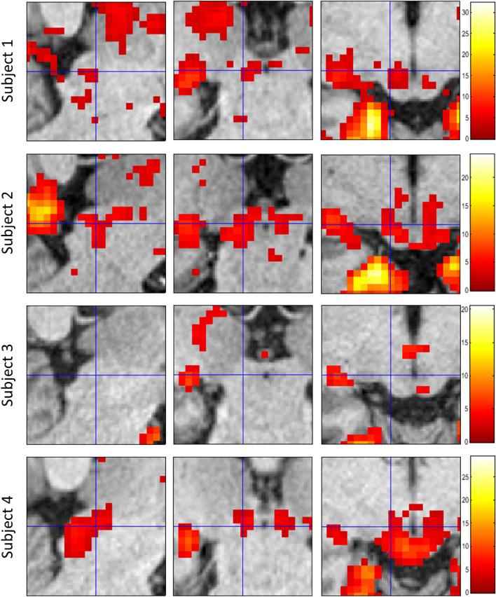 https://cdn.ncbi.nlm.nih.gov/pmc/blobs/2e17/10798994/57a0f18fa4e3/41598_2024_51835_Fig7_HTML.jpg