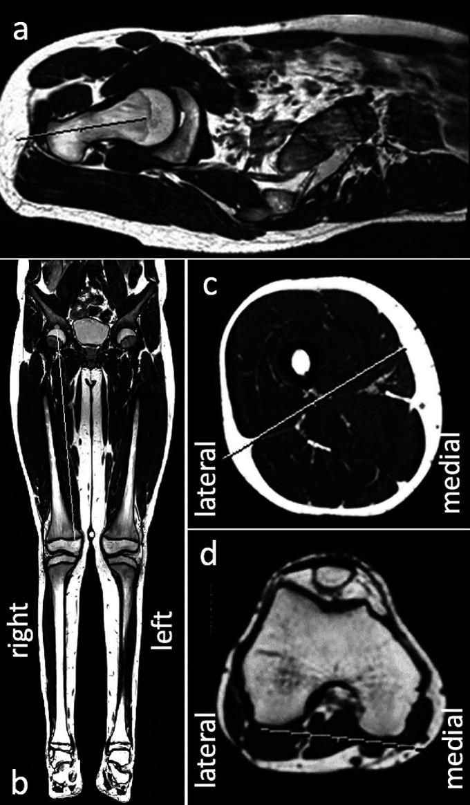 https://cdn.ncbi.nlm.nih.gov/pmc/blobs/2e17/6959918/2c5d1c258358/jbjsoa-4-e0020-g001.jpg