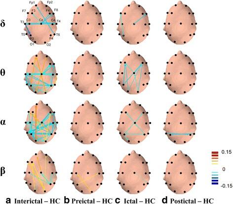 https://cdn.ncbi.nlm.nih.gov/pmc/blobs/2e1a/5093108/f16e9c98774c/10194_2016_697_Fig4_HTML.jpg