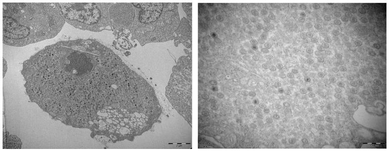 https://cdn.ncbi.nlm.nih.gov/pmc/blobs/2e1b/9959643/183dc04a1dec/viruses-15-00398-g001.jpg