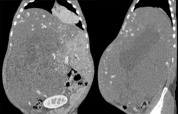 https://cdn.ncbi.nlm.nih.gov/pmc/blobs/2e1d/2936318/1da191c337d6/1752-1947-4-283-1.jpg