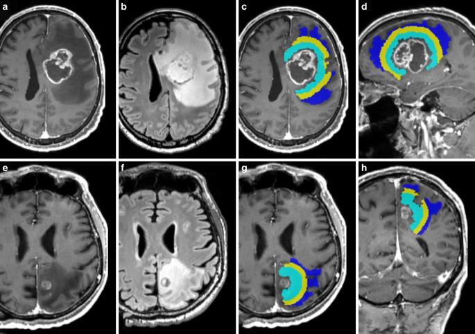 https://cdn.ncbi.nlm.nih.gov/pmc/blobs/2e29/11339137/760faa267afb/62_2024_1416_Fig1_HTML.jpg