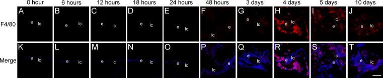 https://cdn.ncbi.nlm.nih.gov/pmc/blobs/2e31/6188467/bee5aaf072ea/i1552-5783-59-12-4986-f05.jpg