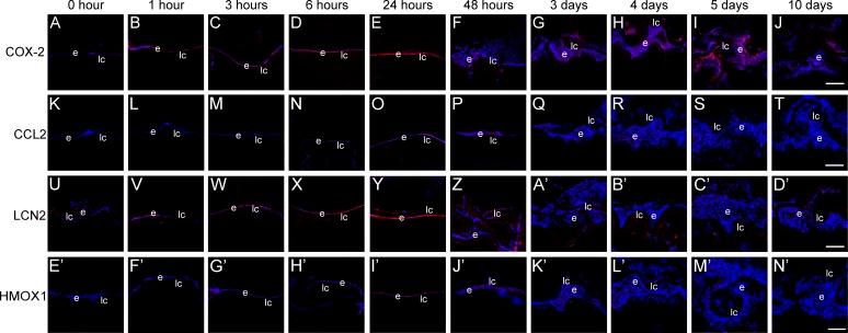 https://cdn.ncbi.nlm.nih.gov/pmc/blobs/2e31/6188467/d24da7eaa988/i1552-5783-59-12-4986-f03.jpg