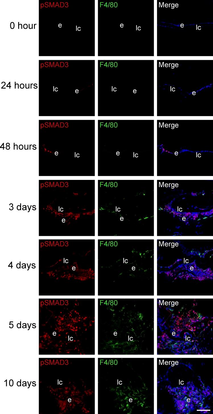 https://cdn.ncbi.nlm.nih.gov/pmc/blobs/2e31/6188467/db293bed72b3/i1552-5783-59-12-4986-f08.jpg
