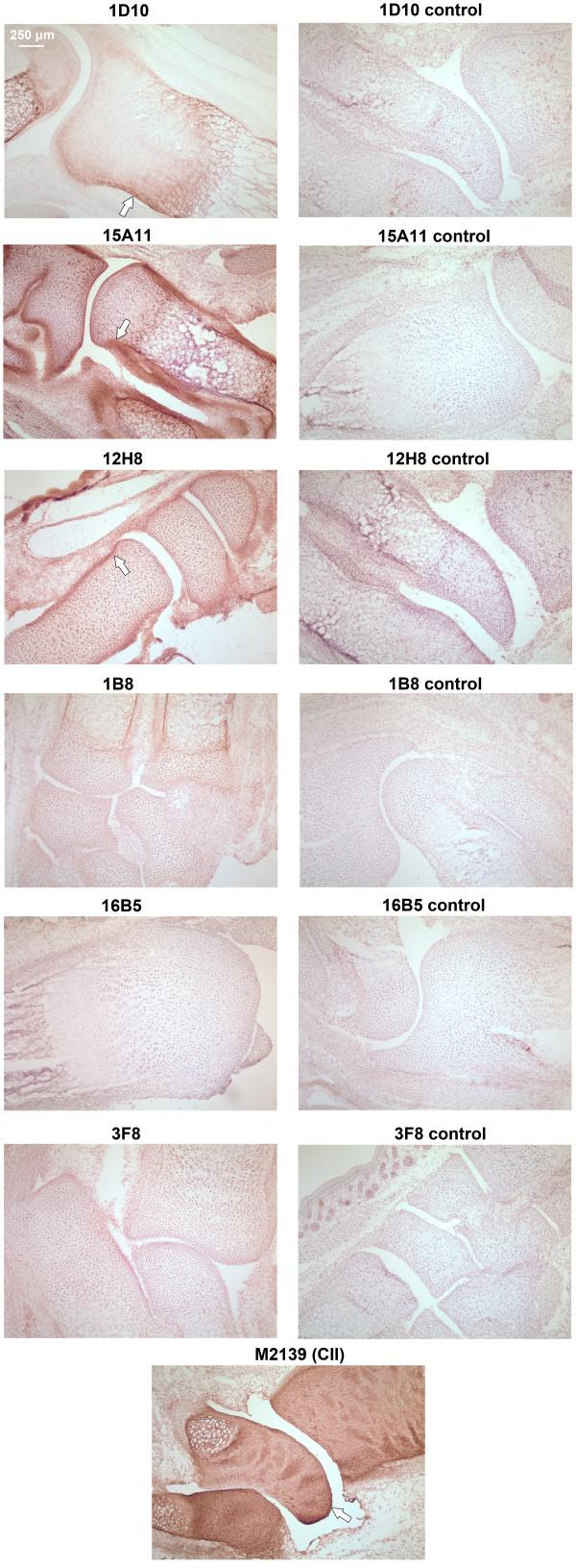 https://cdn.ncbi.nlm.nih.gov/pmc/blobs/2e3b/3580587/6ca6fb72c48f/ar4022-5.jpg