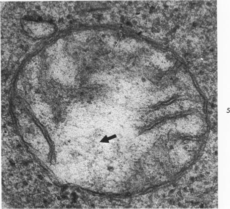 https://cdn.ncbi.nlm.nih.gov/pmc/blobs/2e3e/1904049/023e359f7b7a/amjpathol00248-0049-a.jpg