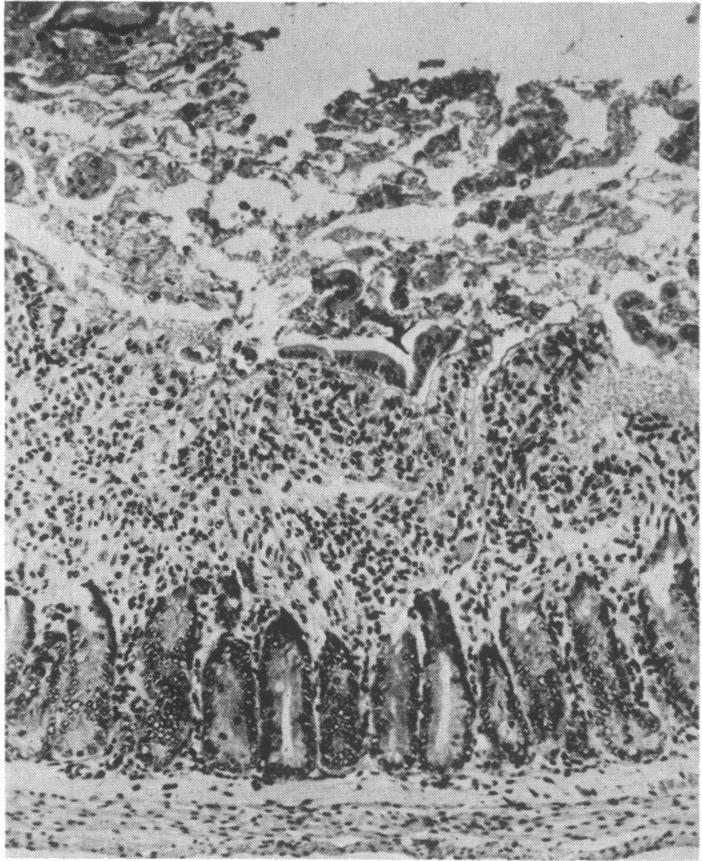 https://cdn.ncbi.nlm.nih.gov/pmc/blobs/2e40/283185/7d013d43c429/pnas00099-0191-b.jpg