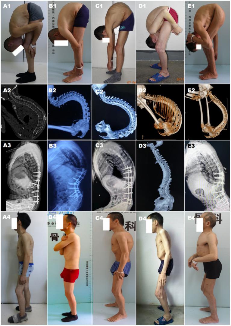 https://cdn.ncbi.nlm.nih.gov/pmc/blobs/2e4c/12040828/2f075d479e07/fmed-12-1503912-g001.jpg
