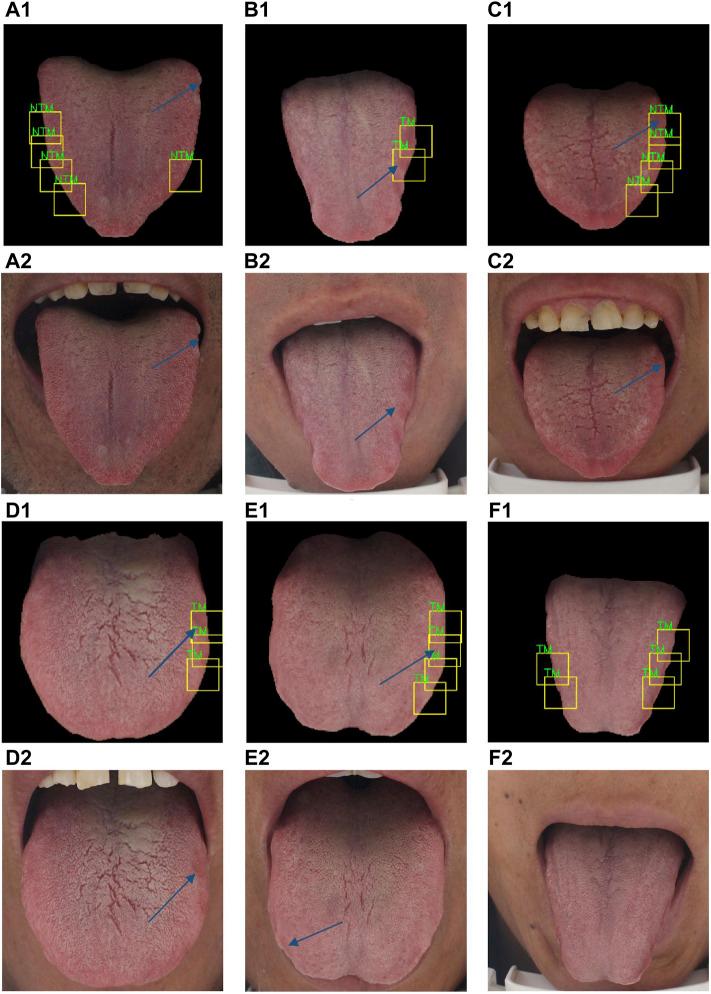 https://cdn.ncbi.nlm.nih.gov/pmc/blobs/2e4f/9039050/02ff9f3e83f1/fphys-13-847267-g008.jpg