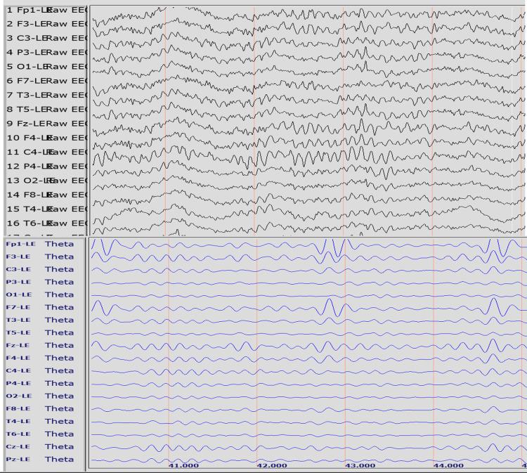 https://cdn.ncbi.nlm.nih.gov/pmc/blobs/2e54/11378327/196d9a765d2e/cureus-0016-00000068771-i01.jpg