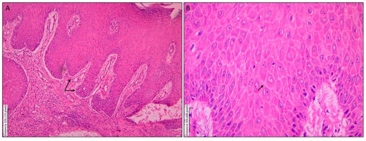 https://cdn.ncbi.nlm.nih.gov/pmc/blobs/2e54/12390503/ba934a7fd628/tropicalmed-10-00232-g001.jpg