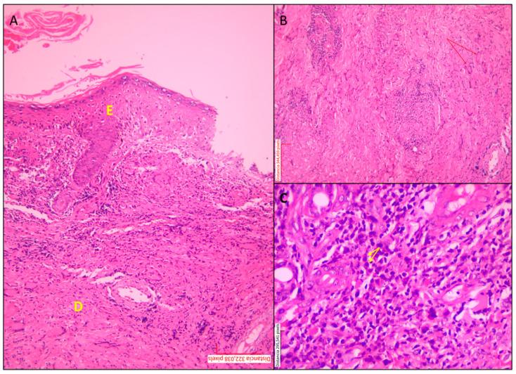 https://cdn.ncbi.nlm.nih.gov/pmc/blobs/2e54/12390503/c3af95e39490/tropicalmed-10-00232-g002.jpg