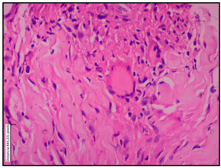 https://cdn.ncbi.nlm.nih.gov/pmc/blobs/2e54/12390503/e85aac7afd06/tropicalmed-10-00232-g003.jpg