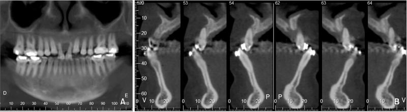 https://cdn.ncbi.nlm.nih.gov/pmc/blobs/2e56/4751301/5d8ff7856c47/kjod-46-42-g006.jpg