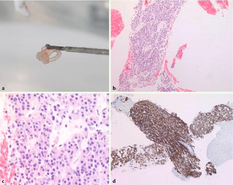 https://cdn.ncbi.nlm.nih.gov/pmc/blobs/2e56/5025313/3b8315451125/10-1055-s-0042-112581-i472ei3.jpg
