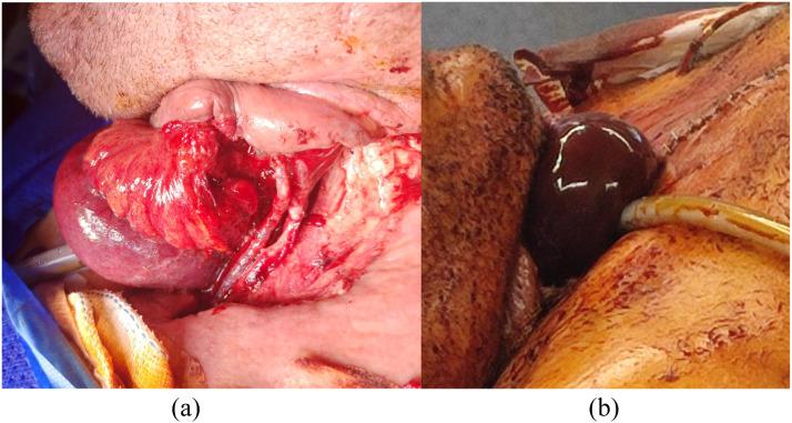 https://cdn.ncbi.nlm.nih.gov/pmc/blobs/2e5d/11156692/cf586c56a399/gr1.jpg
