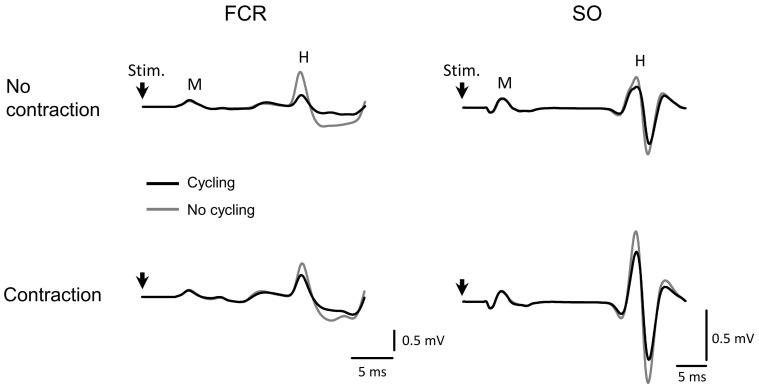 https://cdn.ncbi.nlm.nih.gov/pmc/blobs/2e5f/5496955/fda19ecd805c/fnhum-11-00355-g0003.jpg