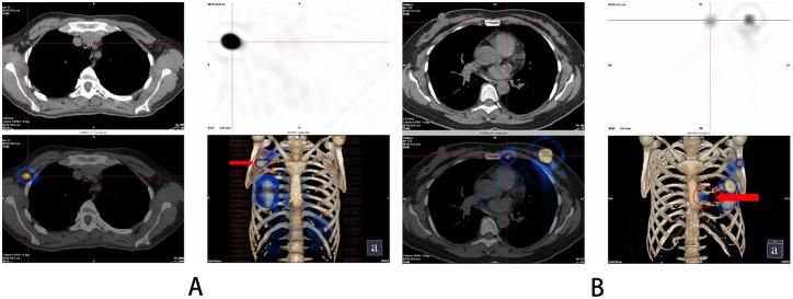 https://cdn.ncbi.nlm.nih.gov/pmc/blobs/2e69/12364937/0821841707e5/fonc-15-1568550-g001.jpg