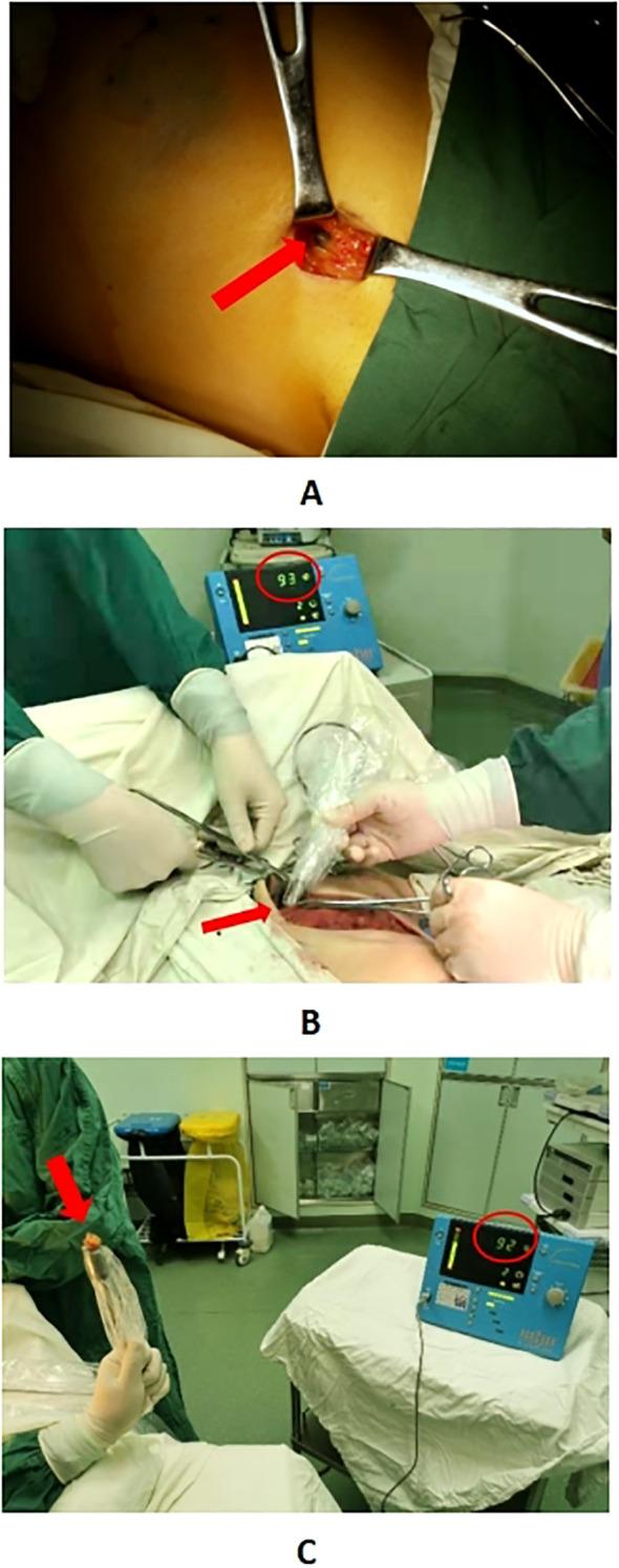 https://cdn.ncbi.nlm.nih.gov/pmc/blobs/2e69/12364937/b9a6d4a44294/fonc-15-1568550-g002.jpg