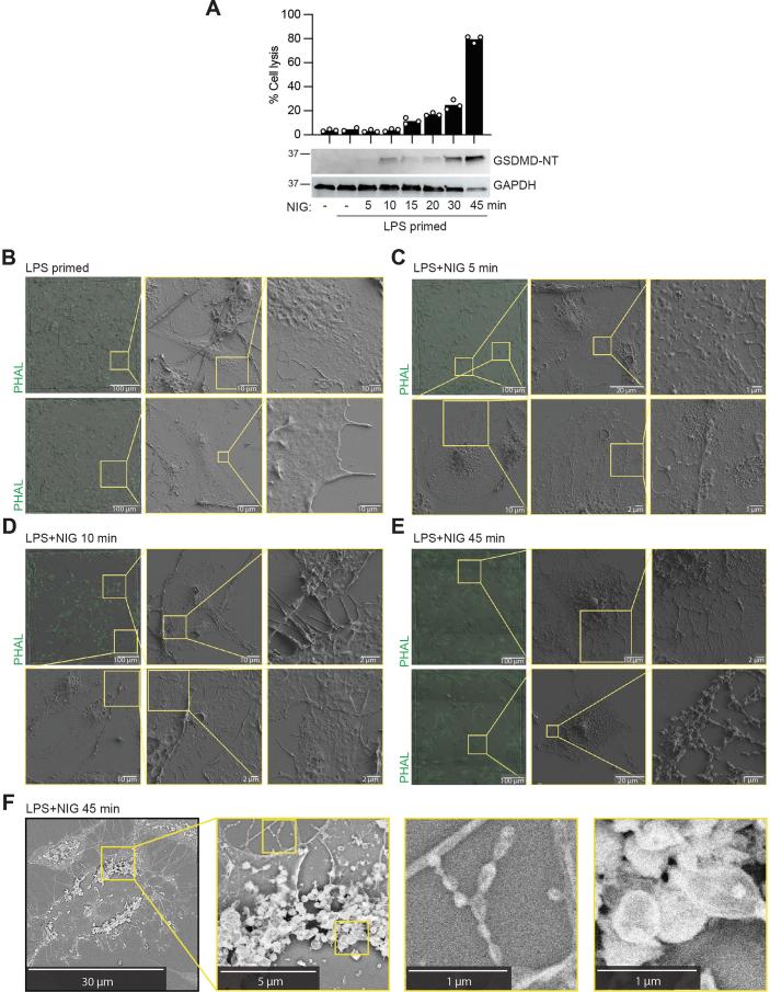 https://cdn.ncbi.nlm.nih.gov/pmc/blobs/2e6b/11695261/5f587cb8c196/41590_2024_2024_Fig11_ESM.jpg