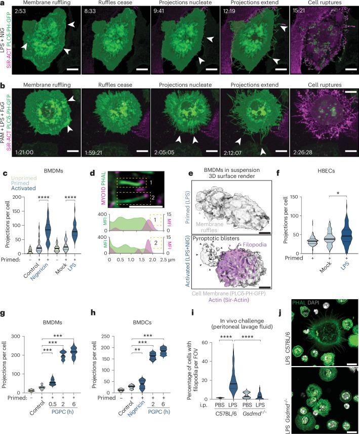 https://cdn.ncbi.nlm.nih.gov/pmc/blobs/2e6b/11695261/b61f4a0fba14/41590_2024_2024_Fig1_HTML.jpg