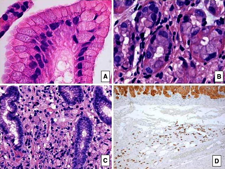 https://cdn.ncbi.nlm.nih.gov/pmc/blobs/2e6d/4803817/cc494317a2fe/10689_2015_9859_Fig1_HTML.jpg