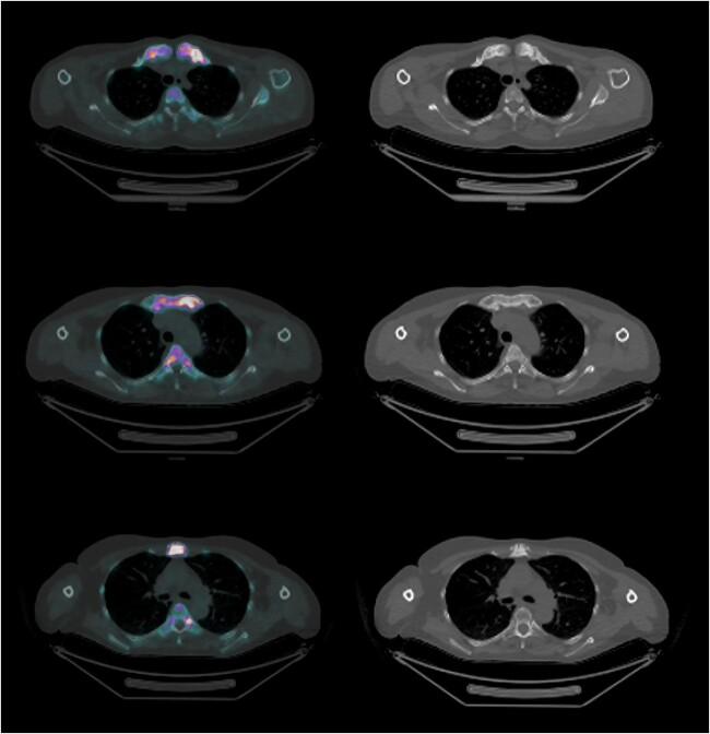 https://cdn.ncbi.nlm.nih.gov/pmc/blobs/2e73/10945721/0b133907658d/ziad007f5.jpg