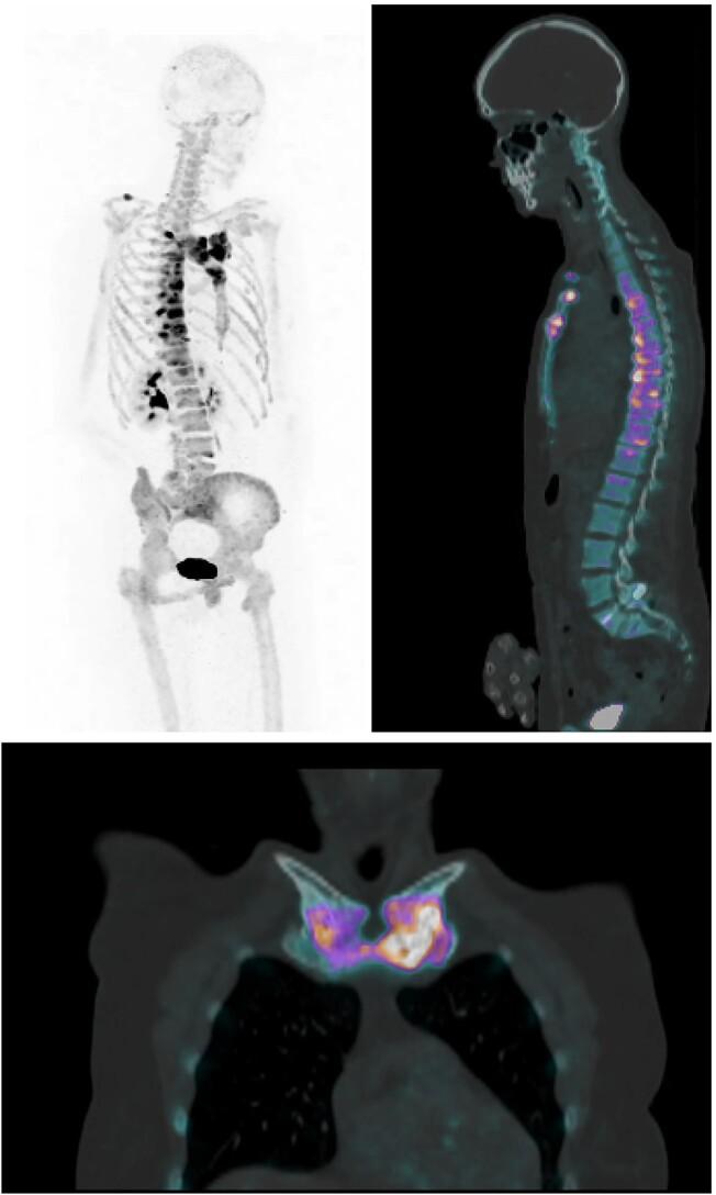 https://cdn.ncbi.nlm.nih.gov/pmc/blobs/2e73/10945721/1a392e76a184/ziad007f4.jpg