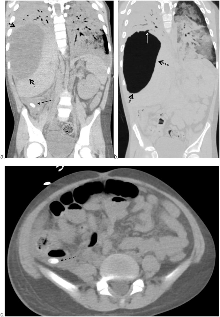 https://cdn.ncbi.nlm.nih.gov/pmc/blobs/2e7a/8860748/b53cea4c855d/gr2_lrg.jpg