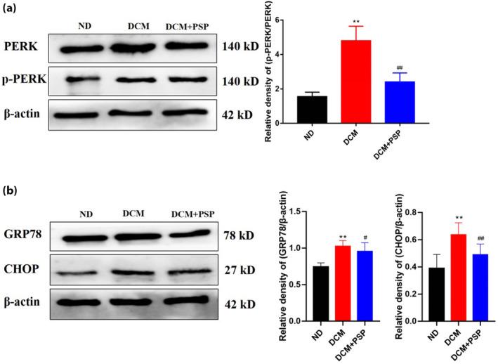 https://cdn.ncbi.nlm.nih.gov/pmc/blobs/2e7d/11215682/442adf444289/JDI-15-823-g004.jpg