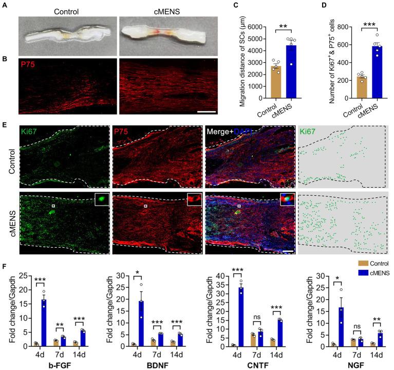 https://cdn.ncbi.nlm.nih.gov/pmc/blobs/2e7e/10885699/cb25f1eeaa21/fnins-18-1361590-g002.jpg