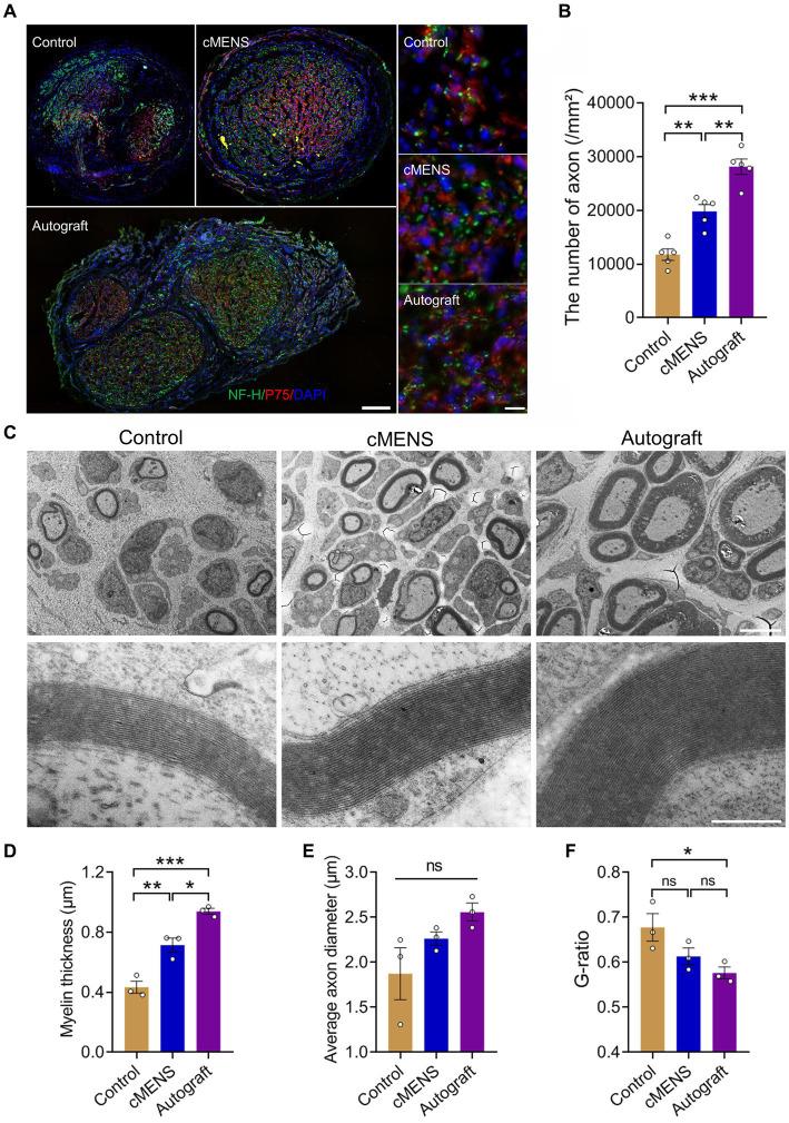 https://cdn.ncbi.nlm.nih.gov/pmc/blobs/2e7e/10885699/de3766e149ae/fnins-18-1361590-g006.jpg