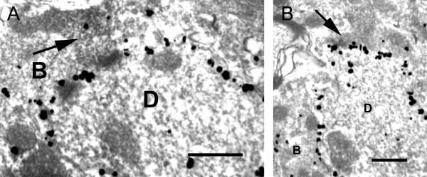 https://cdn.ncbi.nlm.nih.gov/pmc/blobs/2e7e/3495683/016acbe3ad1b/1744-8069-8-64-8.jpg