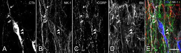 https://cdn.ncbi.nlm.nih.gov/pmc/blobs/2e7e/3495683/88886b7f6c49/1744-8069-8-64-5.jpg