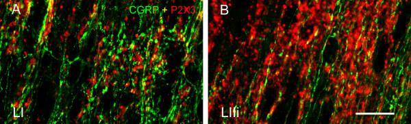 https://cdn.ncbi.nlm.nih.gov/pmc/blobs/2e7e/3495683/ab280560b165/1744-8069-8-64-3.jpg
