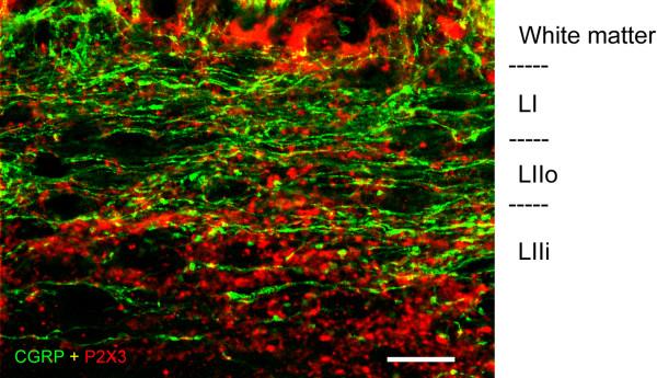 https://cdn.ncbi.nlm.nih.gov/pmc/blobs/2e7e/3495683/d006e484a99a/1744-8069-8-64-2.jpg