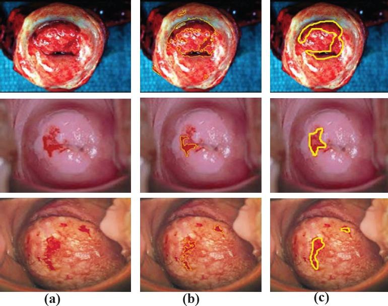 https://cdn.ncbi.nlm.nih.gov/pmc/blobs/2e7f/6318403/e51bca3cae58/APJCP-19-3203-g024.jpg