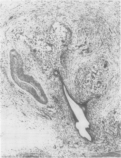 https://cdn.ncbi.nlm.nih.gov/pmc/blobs/2e82/1140974/9596681ea00c/jclinpath00324-0054-b.jpg