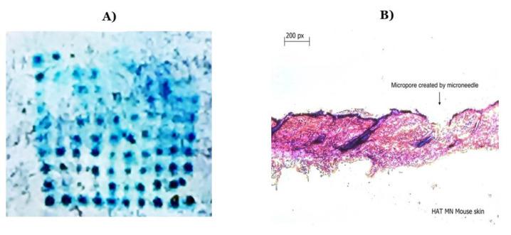 https://cdn.ncbi.nlm.nih.gov/pmc/blobs/2e86/10144232/fc9e36760d3b/vaccines-11-00866-g003.jpg