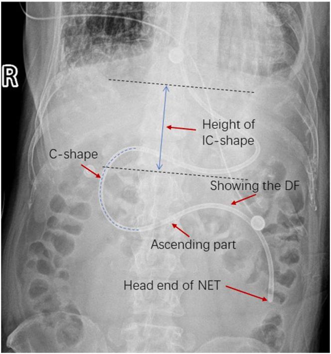 https://cdn.ncbi.nlm.nih.gov/pmc/blobs/2e88/11408785/4ba9fb25ab55/gr2.jpg