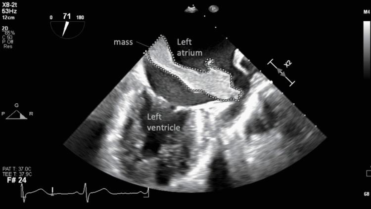 https://cdn.ncbi.nlm.nih.gov/pmc/blobs/2e8a/9237856/1521e8889971/cureus-0014-00000025440-i01.jpg